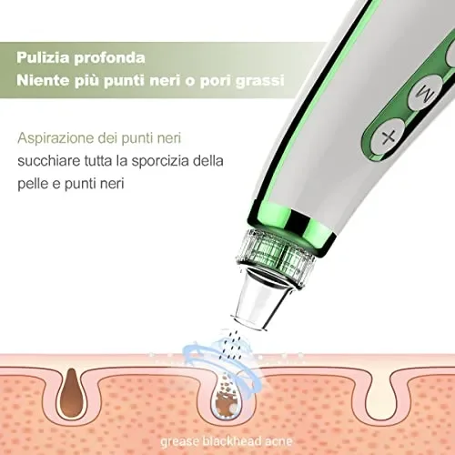 Aspiratore Punti Neri Professionale Rimozione di Comedone Viso Pulitore dei Pori Vacuum Ricaricabile USB Display a Schermo 5 Testine per Estrattore Comedone Brufoli Grasso 7 Aghi per l’Acne - immagine 3