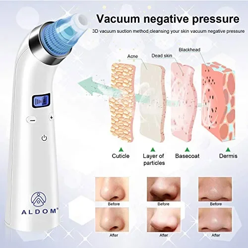 Aspiratore Punti Neri Rimozione di Comedone Aspira Estrattore… Online ora - immagine 2