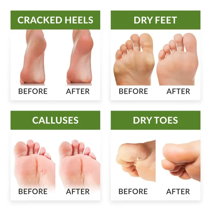 FitFoot maschera piedi esfoliante baby foot peeling calzini Verde - immagine 3