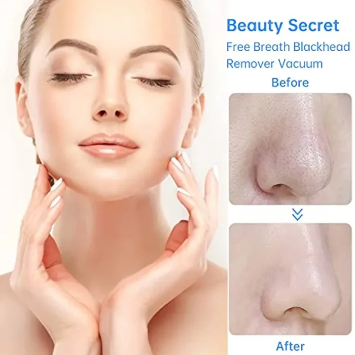 FREEBREATH Aspiratore Punti Neri, 2021 Più Nuovo Punti Neri Strumenti, Punti Neri Aspirazione Professionale, Punti Neri Rimozione Pulizia di Viso USB Riccaricabile con 6 Sonde Sostituibili - immagine 2